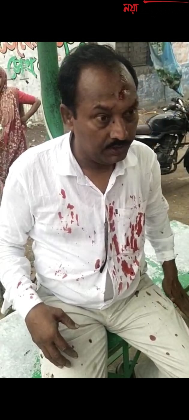 দ্বিতীয় দফা শুরুর আগেই ঝরল রক্ত, চাপড়ায় বিজেপি এজেন্টের মাথা ফাটানোর অভিযোগ তৃণমূলের বিরুদ্ধে!