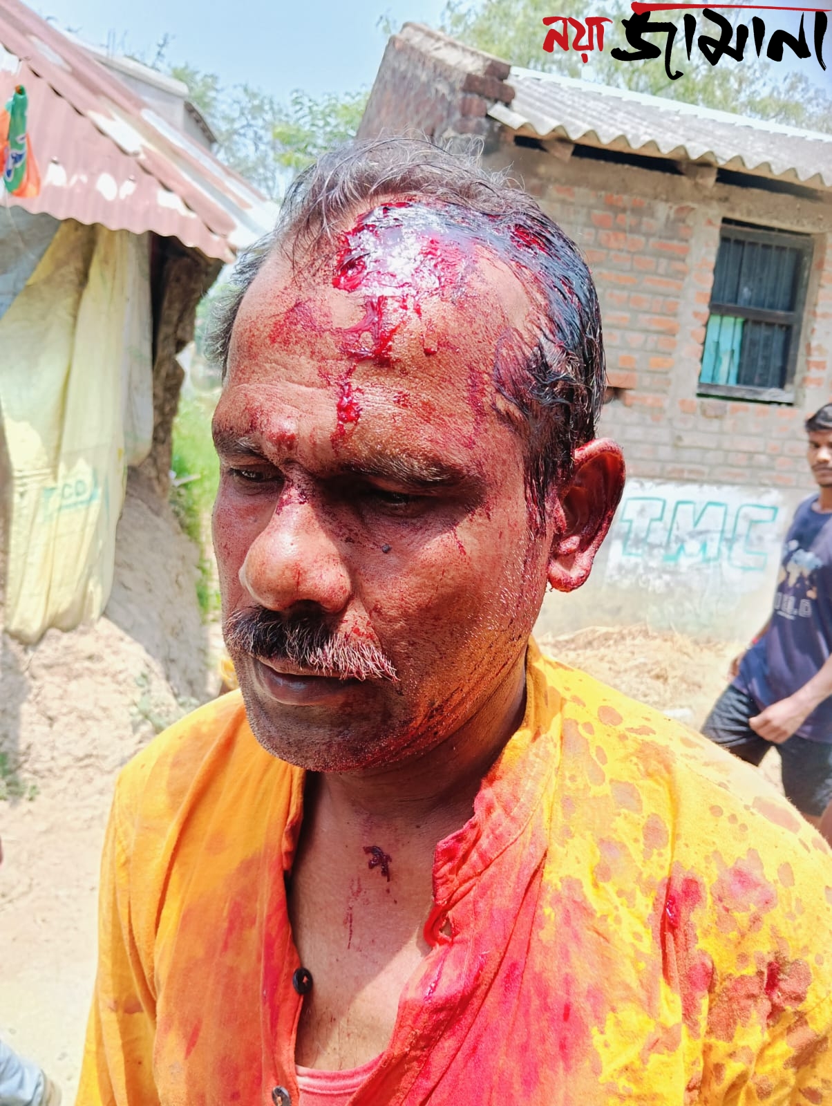 বিজেপি এজেন্টের মাথা ফাটানোর অভিযোগ তৃণমূলের বিরুদ্ধে, উত্তপ্ত লাভপুর